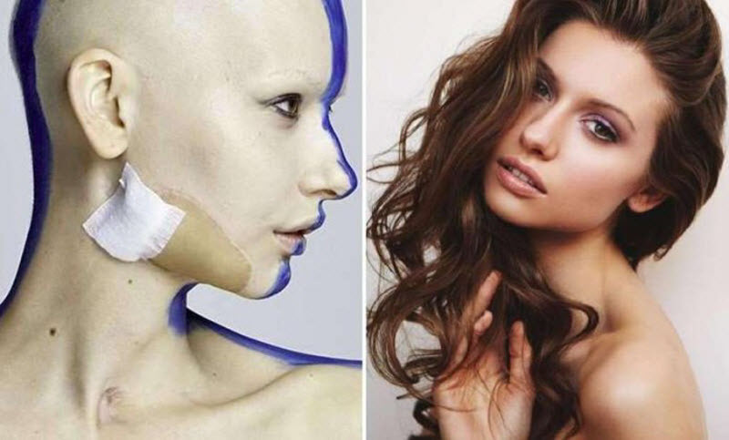 фото для записи Невероятные фотографии модели, потерявшей челюсть из-за рака
