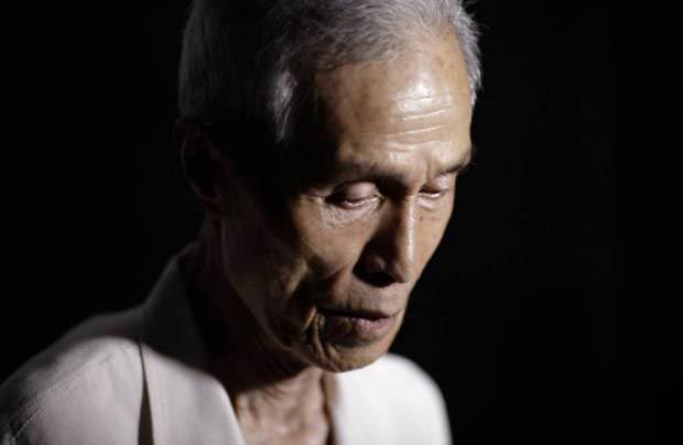 фото для записи Японец показал шрамы оставленные ему после взрыва атомной бомбы