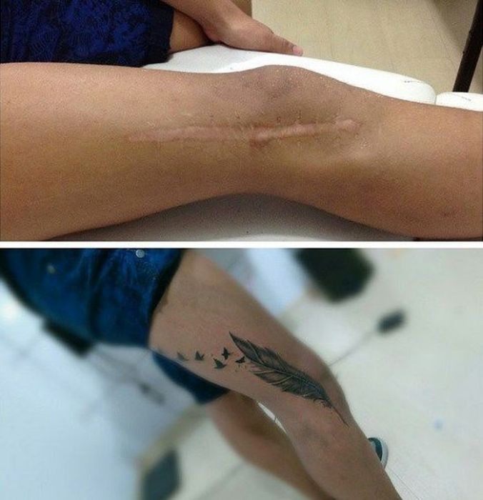 фото для записи Спрятали шрамы под татуировками